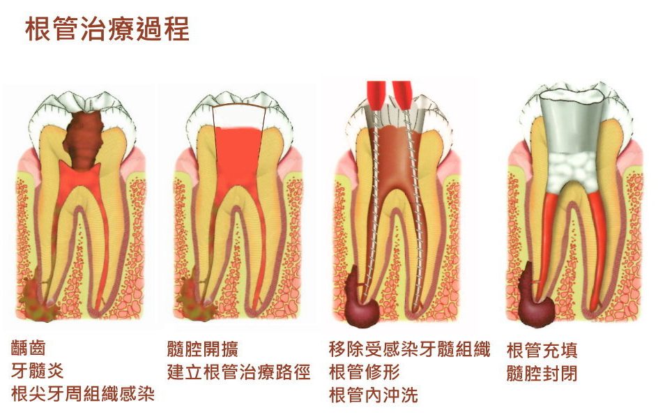 牙科术语中英文对照 Xsimplr